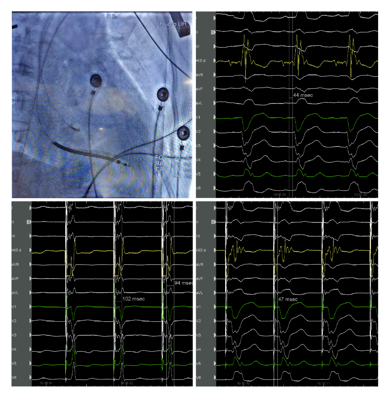 1574739965110049631.png 拼图HIS位置.png